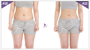 若隐若现的性感  凹凸曲线更迷人