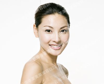 埋线双眼皮手术 打造有神大眼