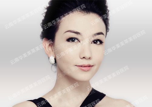脸颊有黄褐斑怎么办