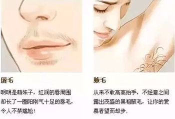 脱毛