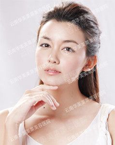 昆明下巴整形要多少钱